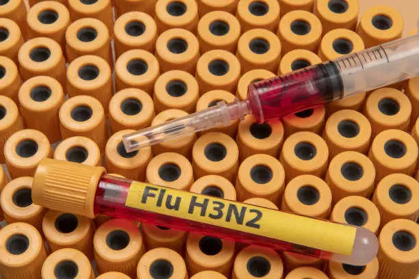 H2N3 इन्फ्लूएंजा को लेकर RIMS में 24 बेड रिजर्व 24 bed reserve in RIMS regarding H2N3 influenza