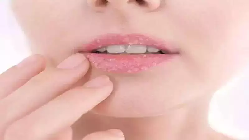 5 Simple ways to treat chapped lips