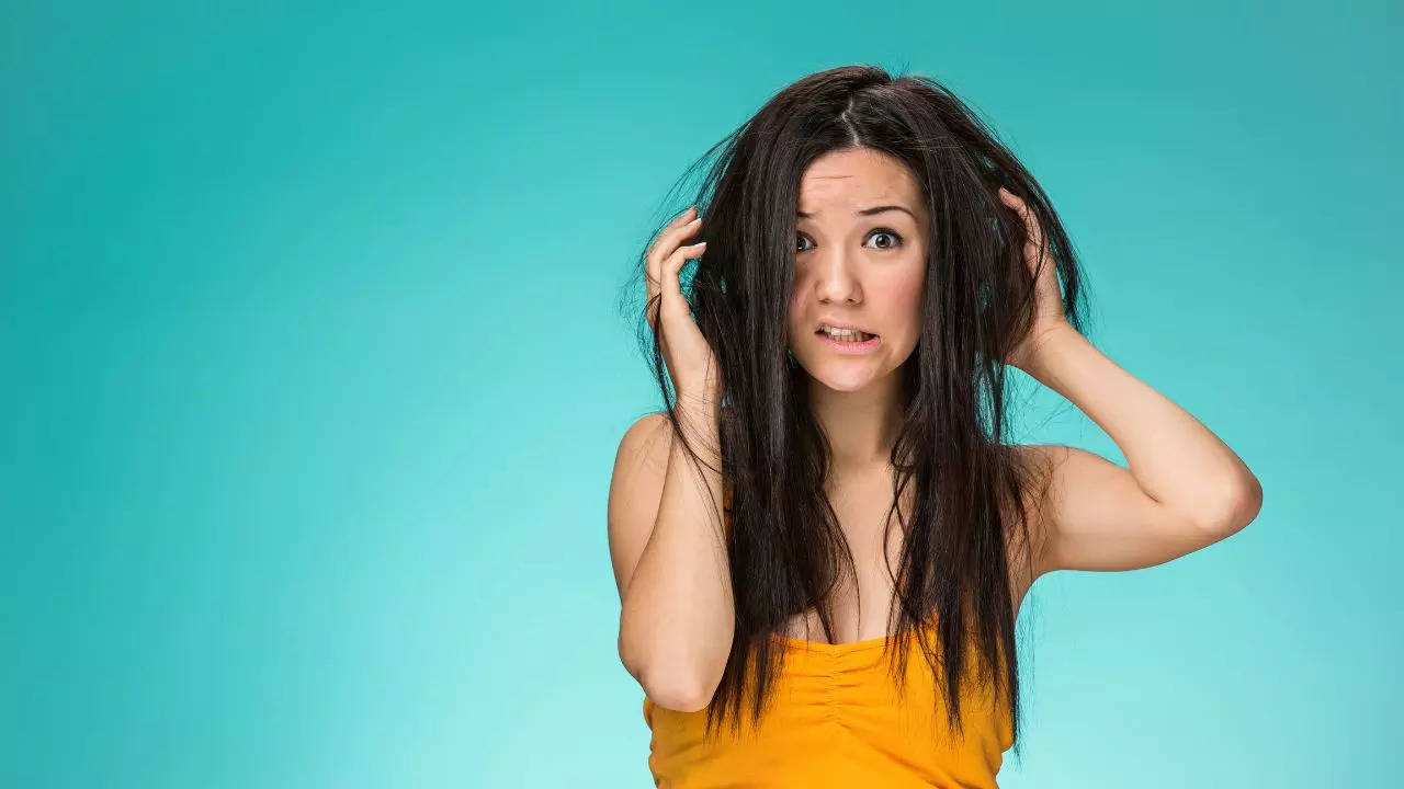 Dandruff home remedies