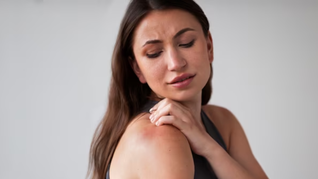 Ayurvedic Remedies To Get Rid Of Heat Rashes This Summer