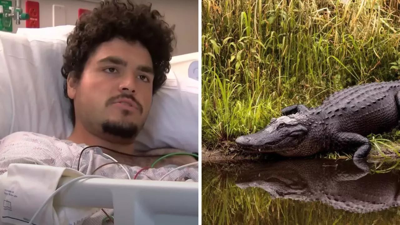 Jordan Rivera lost his arm in an alligator attack while relieving himself behind a Florida bar | NBC2