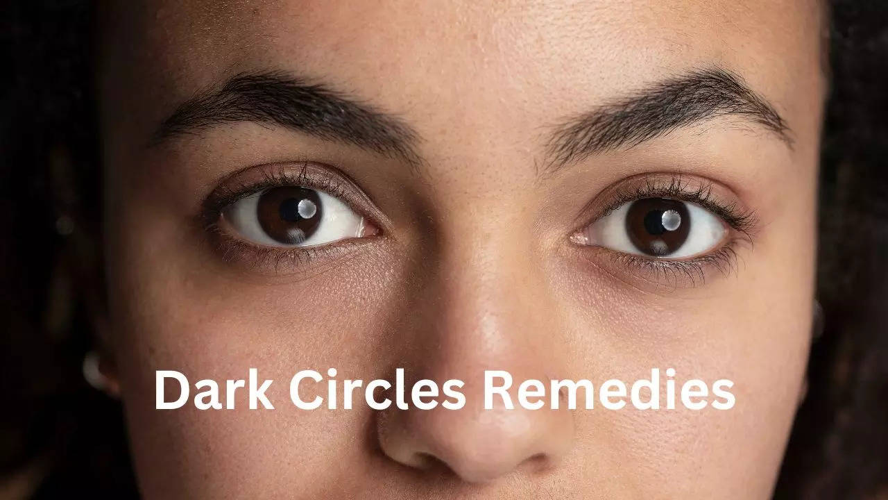 Remove Dark Circles  15 Natural Remedies To Get Rid of Dark