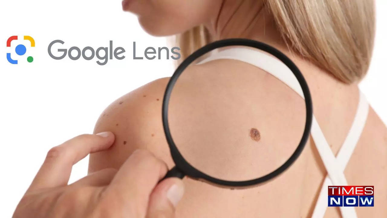 Google Lens, Your Pocket Dermatologist