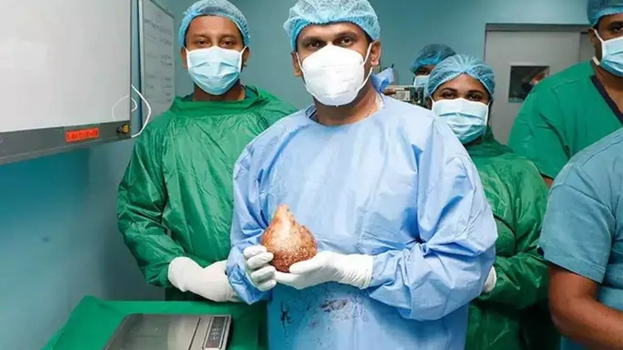 Sri Lankan doctors pictured with the largest kidney stone ever removed from a patient | Guinness World Records