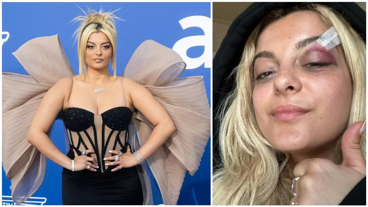 Singer Bebe Rexha Injured During NYC Concert