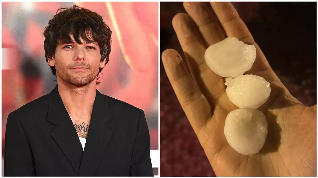 Louis Tomlinson's Concert Pelted With Golf Ball-Sized Hail