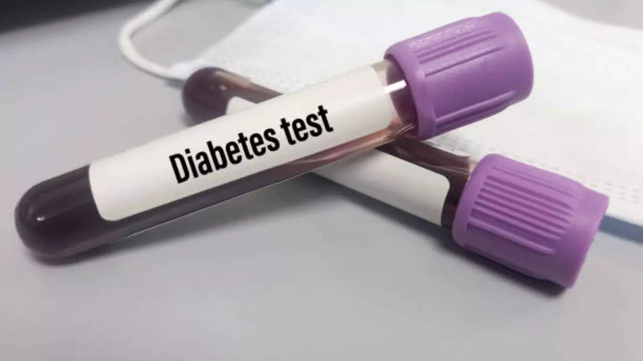 Diabetes Monitor: What is HbA1C Test, Who Should Get It and At What Intervals - Vimarsana News