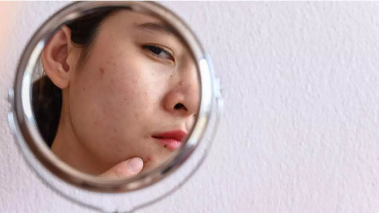 Skin Barrier: What is Your Skin Barrier and How to Repair and Protect It - Vimarsana News