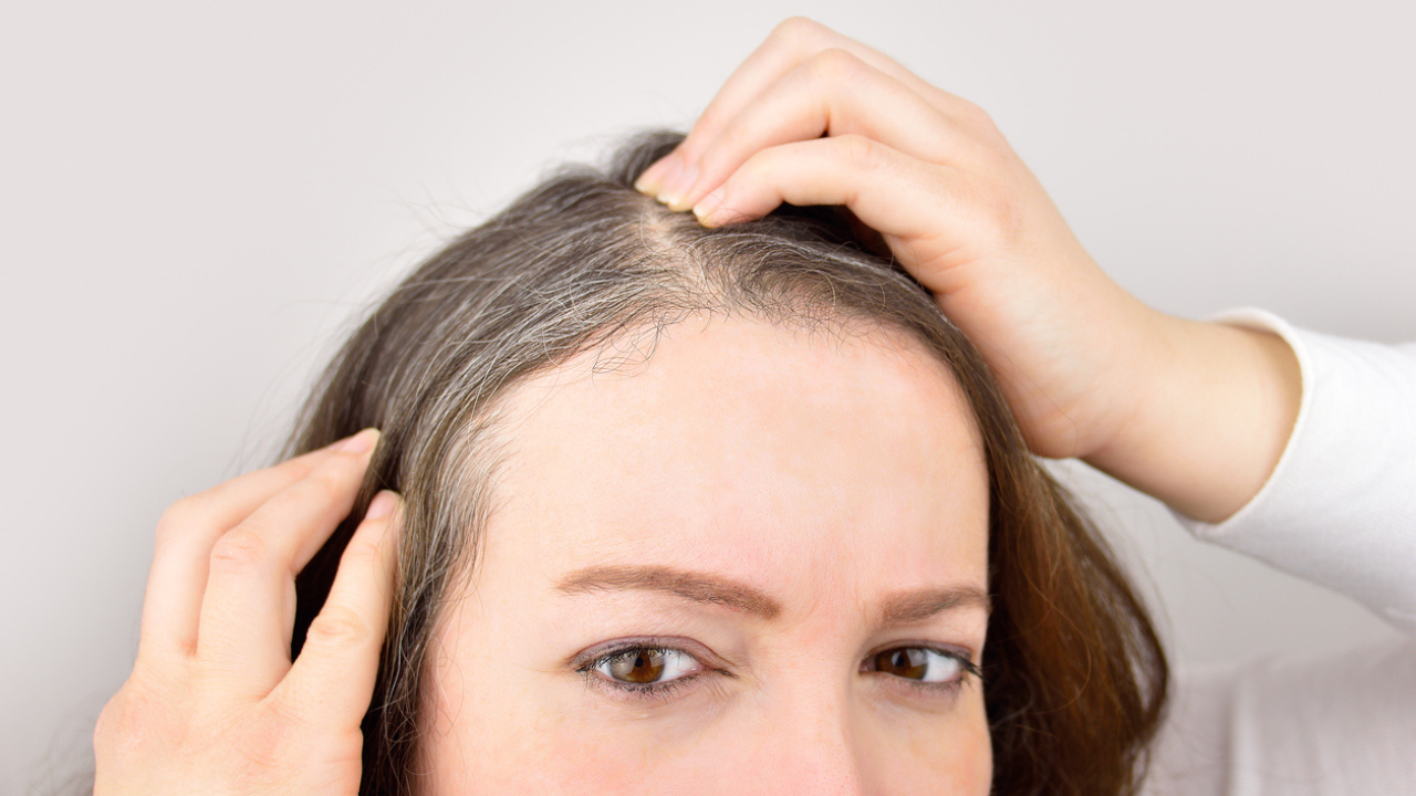 Premature Greying Of Hair