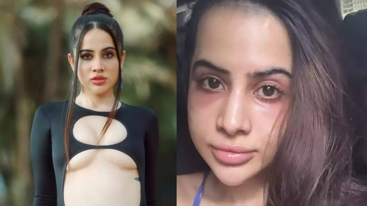 My Face Looks F**ked Up! Urfi Javed REGRETS Getting Eye-Fillers After Being Trolled Over Dark Circles