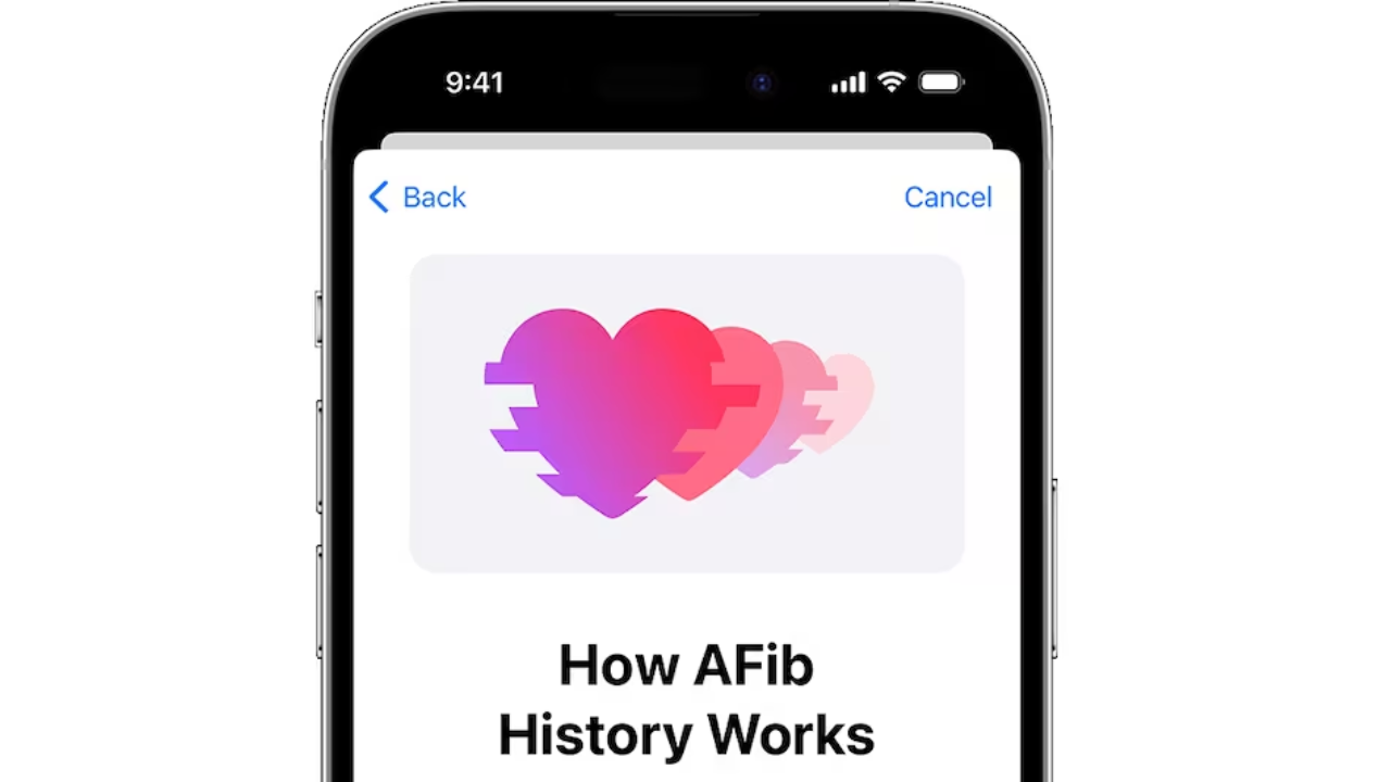 Apple Watch AFib History