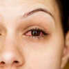 AIIMS Reports 100 Cases of Conjunctivitis Daily Heres How You Can Prevent and Combat Pink Eyes