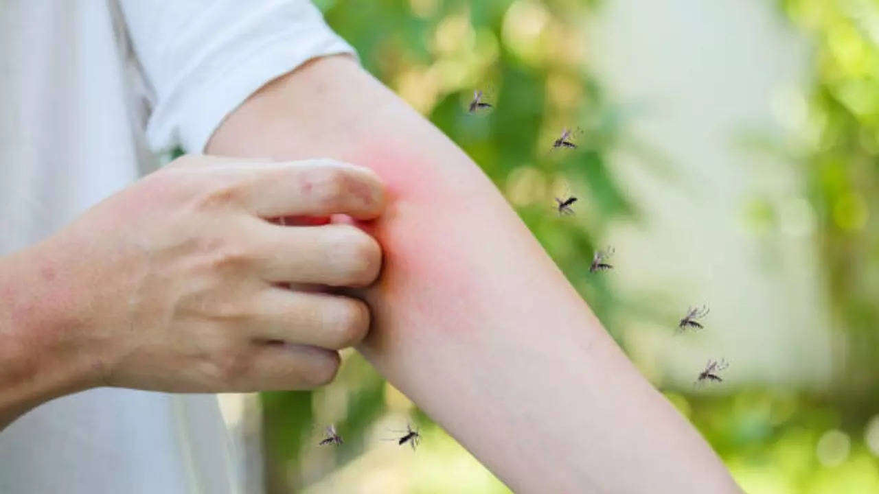 Dengue Cases in Delhi: Capital Sees a Surge in Infections, Here's How You Should Keep Yourself Protected | Health News, Times Now