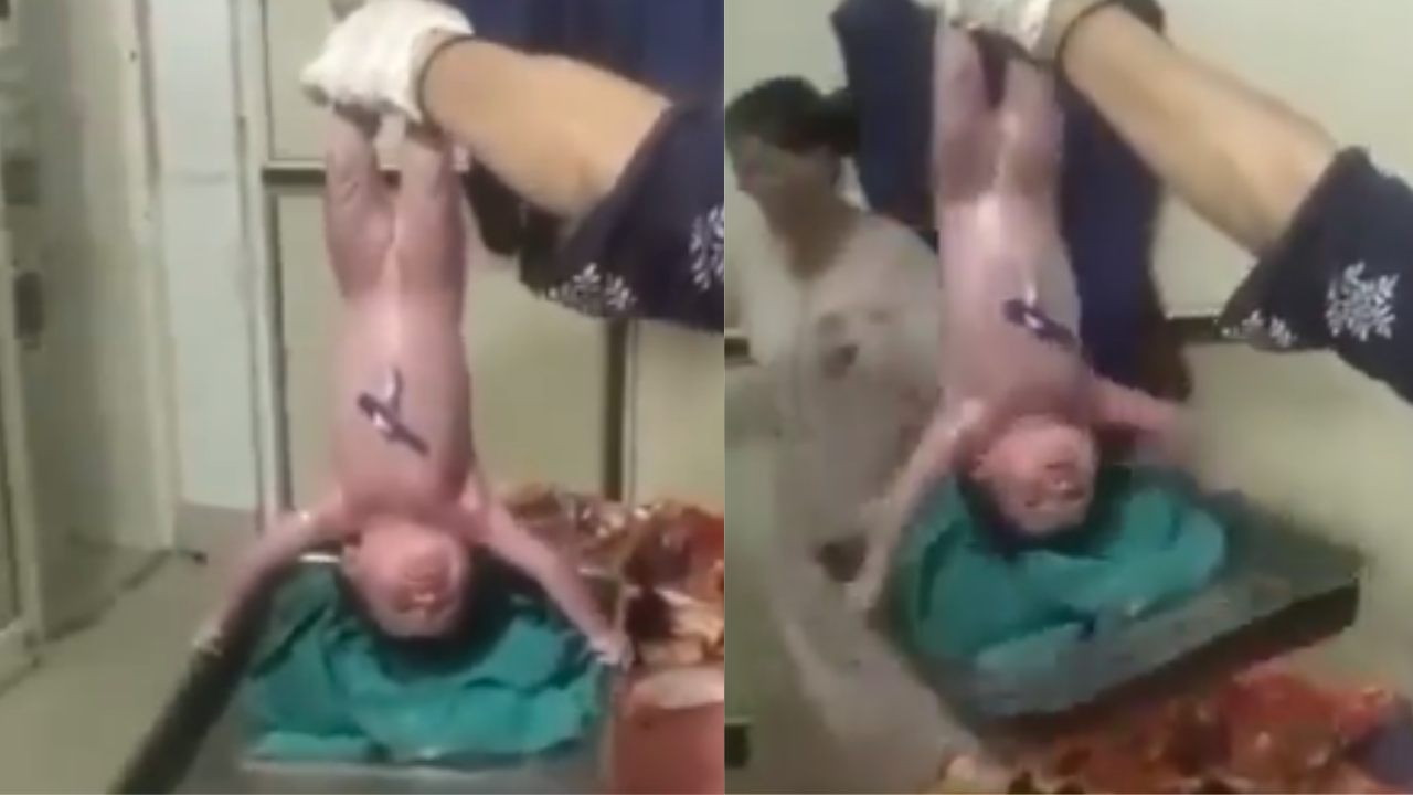 Viral Video: The scene unfolds just moments after the child's birth, as the nurse holds the baby upside down, following standard medical practices to clear the airways.