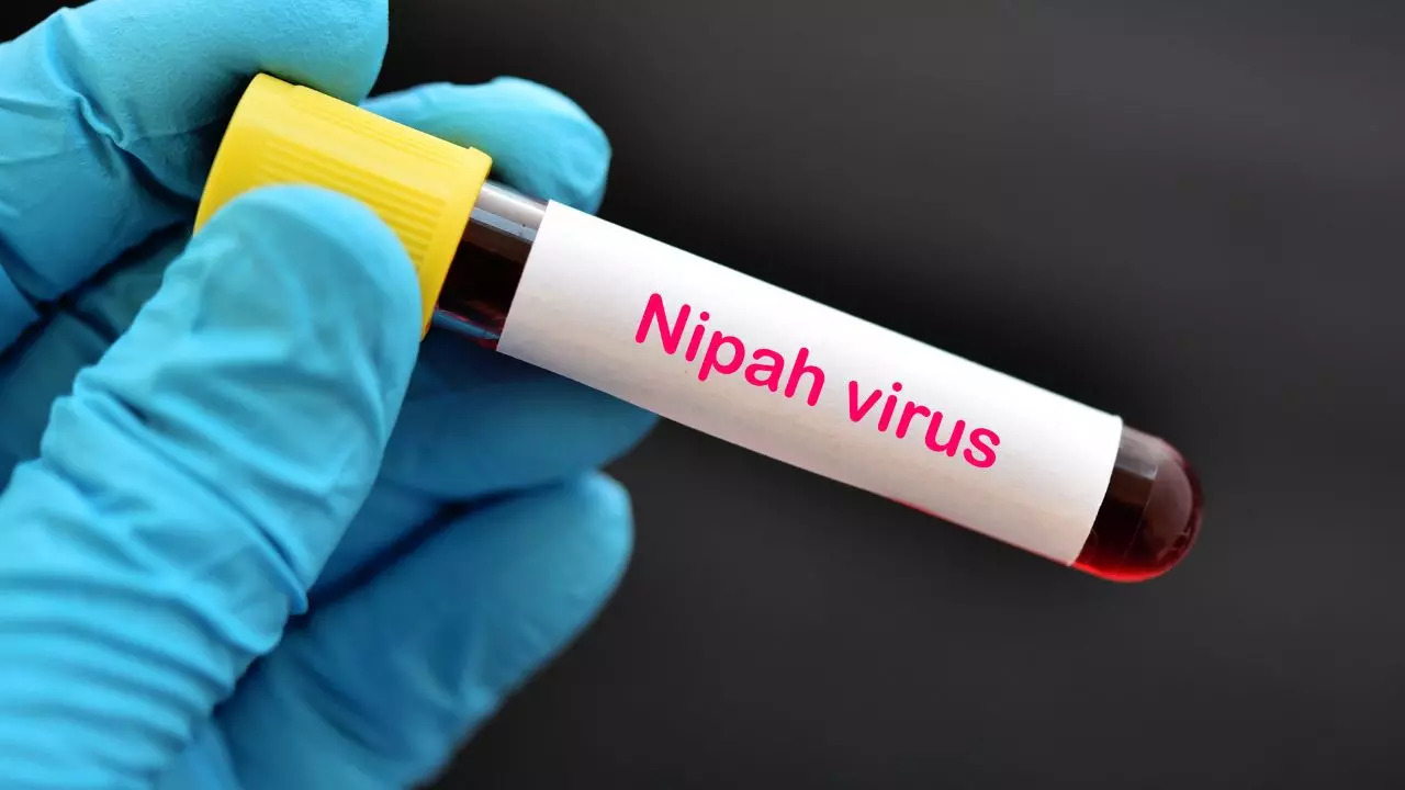 Nipah Virus Case