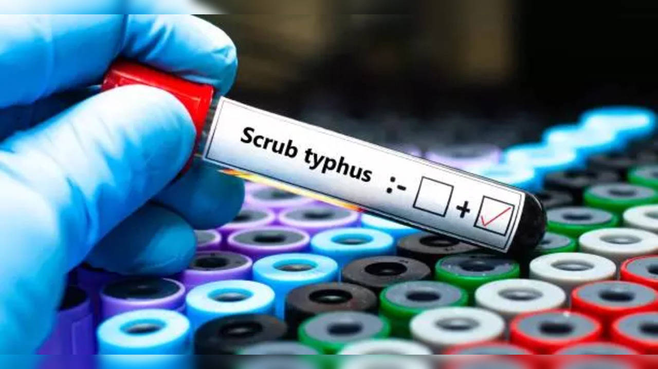 scrub typhus