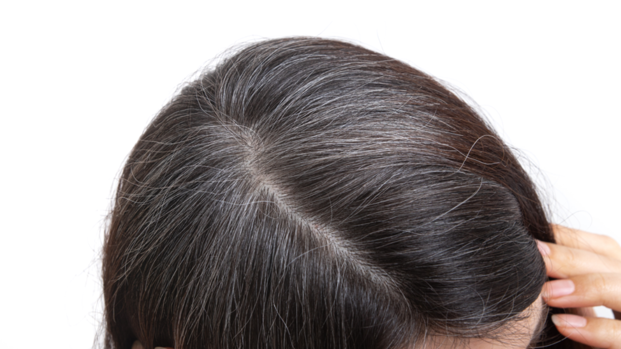 8 natural Ayurvedic remedies to prevent premature hair greying. Pic Credit: Vecteezy