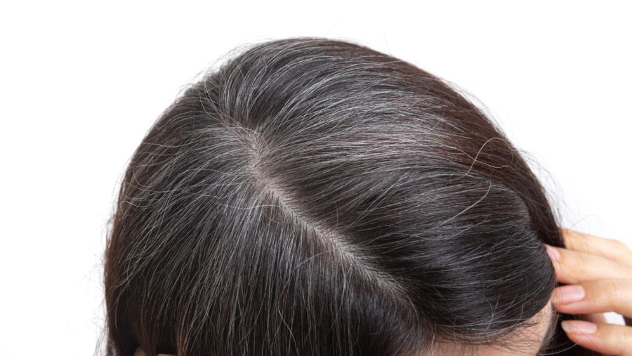 8 Ayurvedic Natural Remedies To Prevent Premature Hair Greying