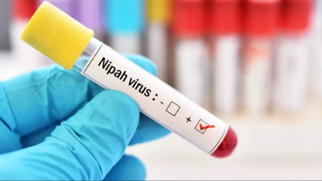 nipah virus