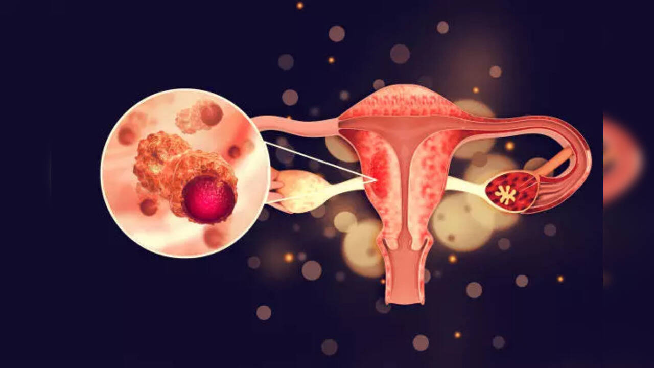 Why Are Women's Cancers So Difficult to Detect?