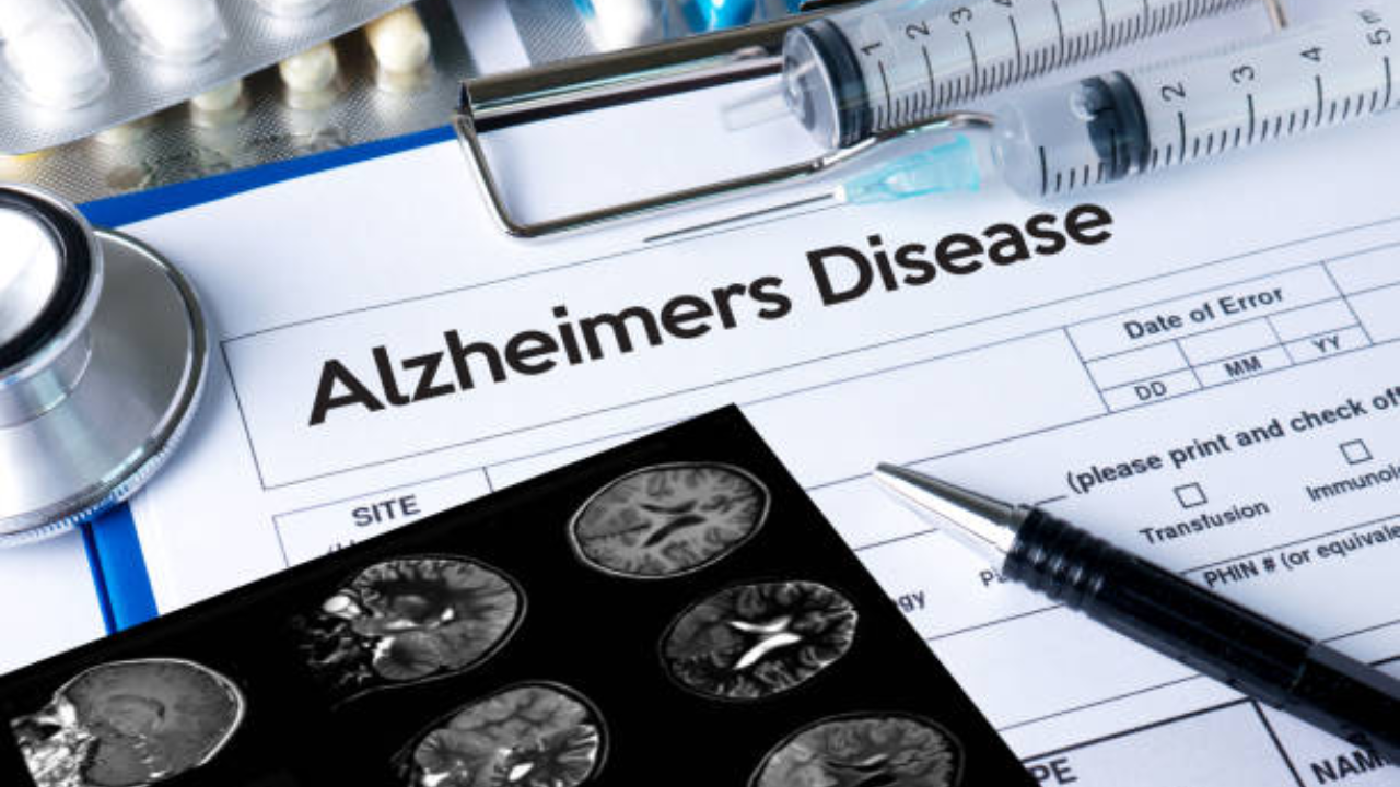 Alzheimer's Disease