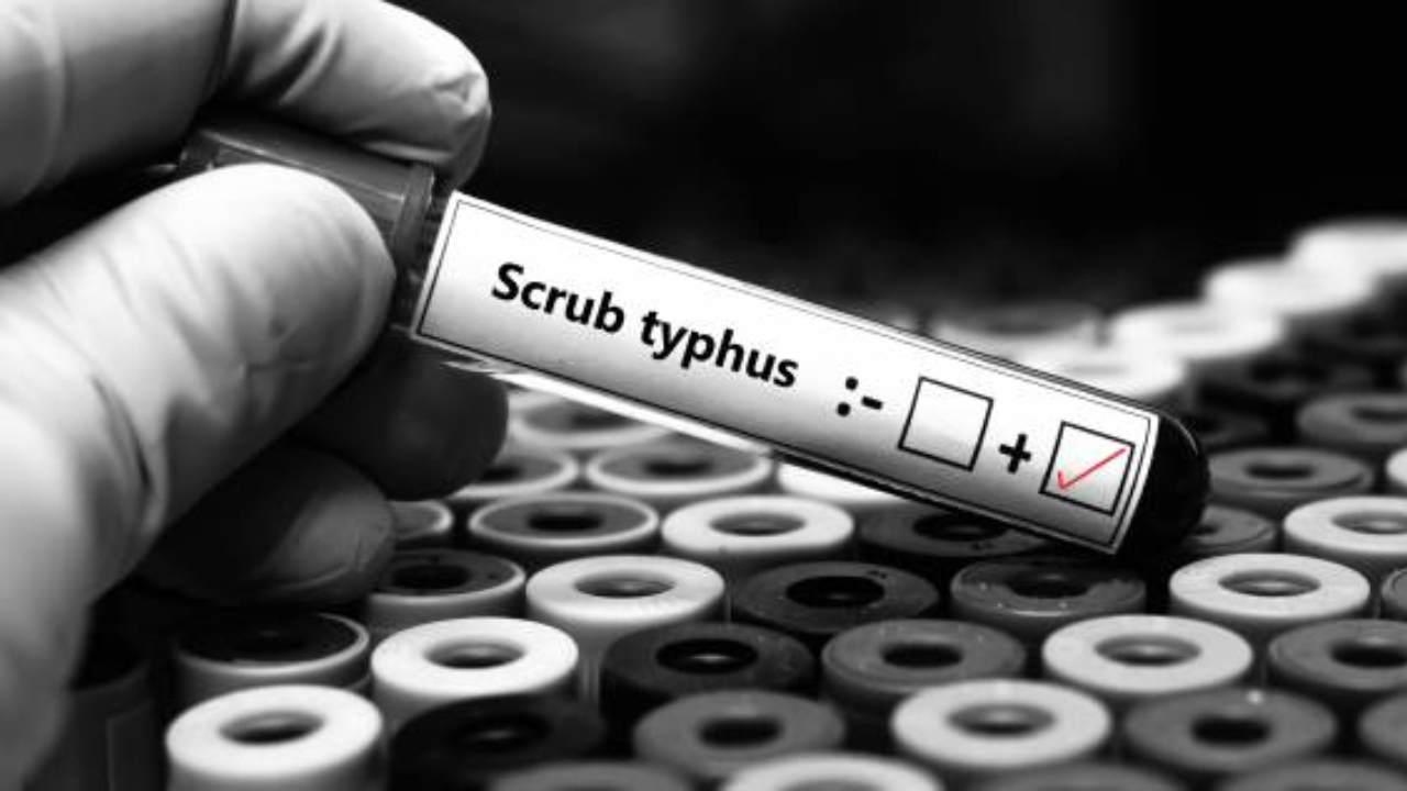 Scrub Typhus