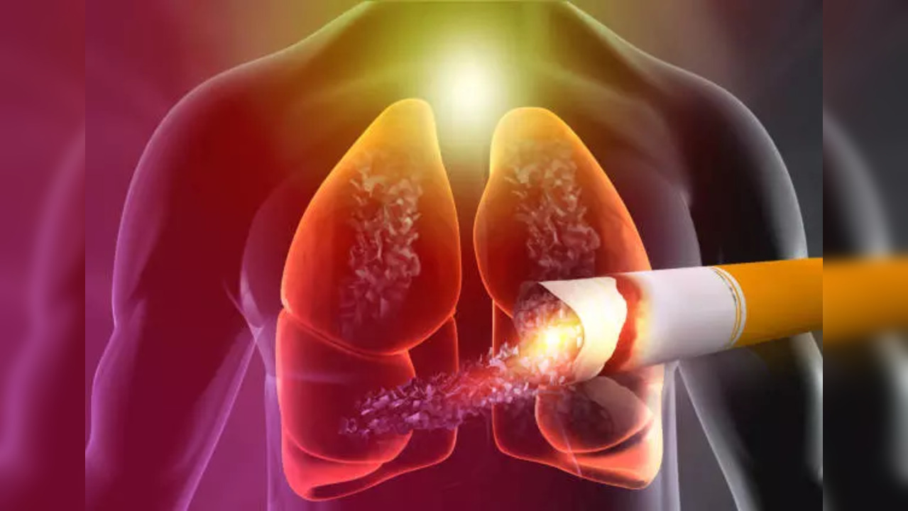 World Lung Day 2023 5 Harmful Effects Of Smoking; Easy Tips To Quit Health News, Times Now