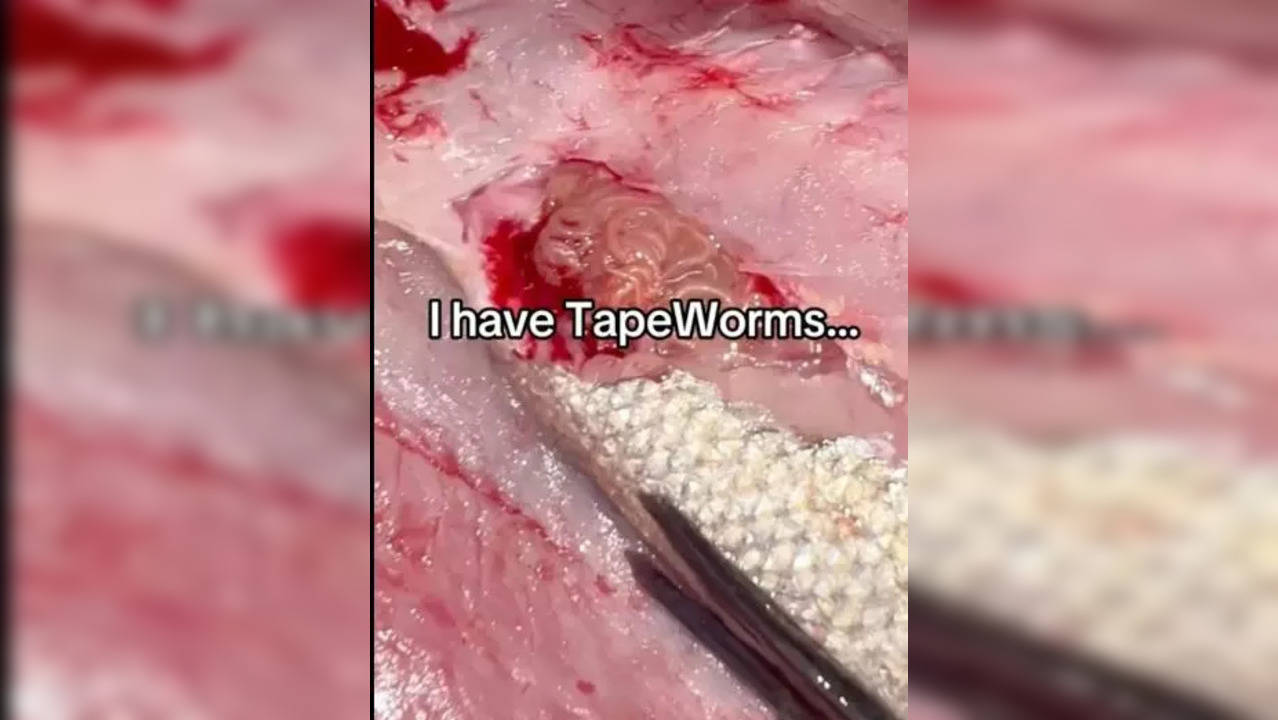 tapeworms