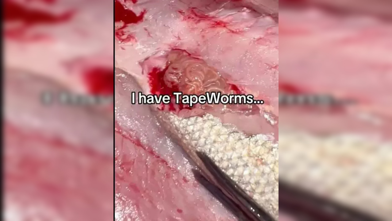 tapeworms