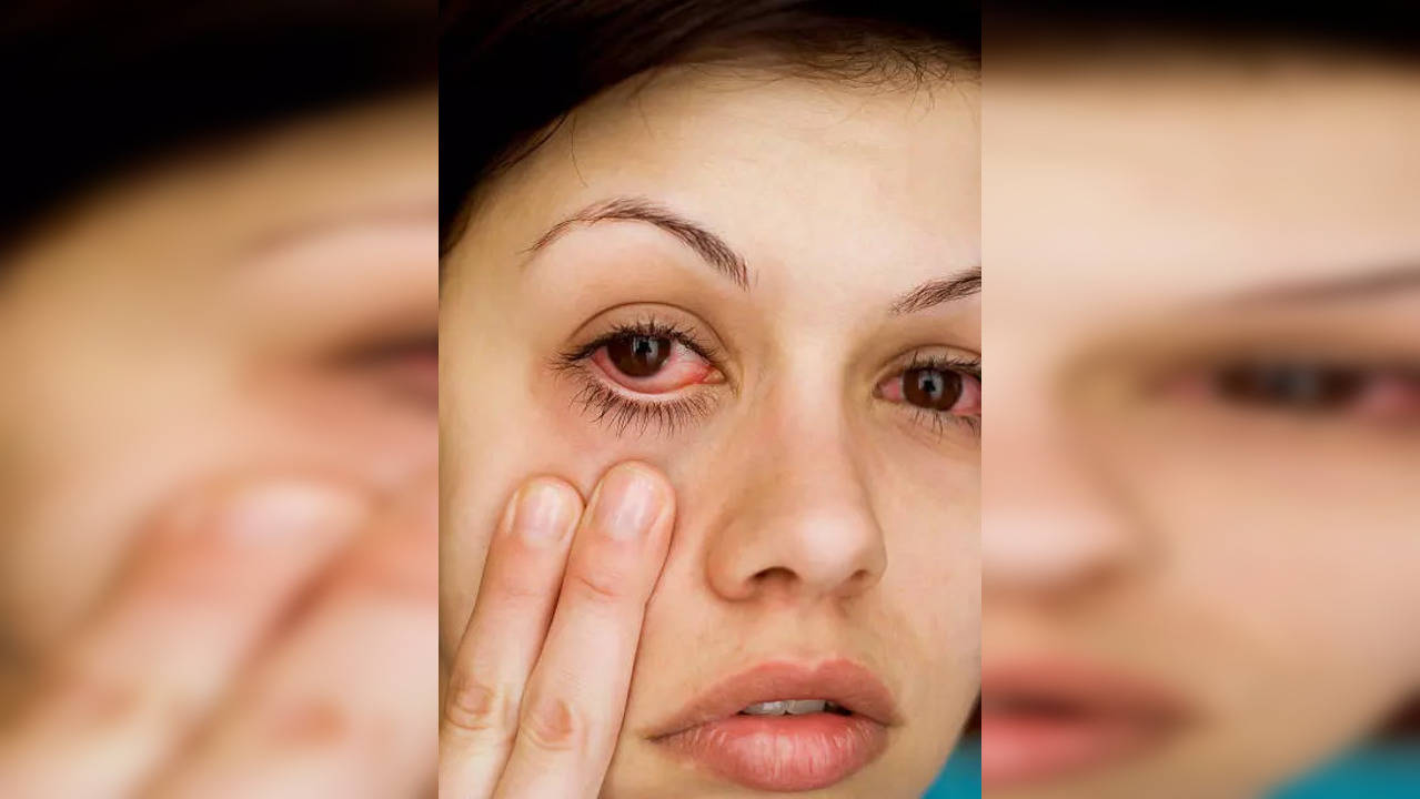 arthritis in eyes