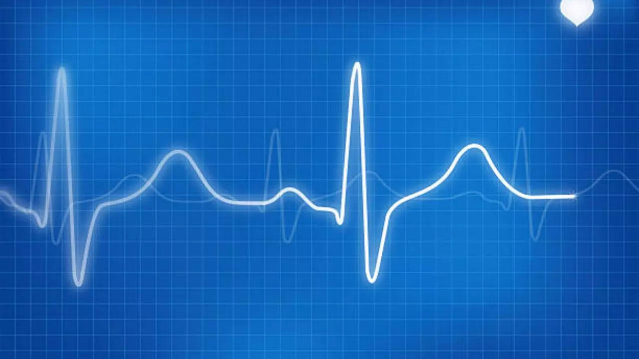 Heartbeat and Stroke