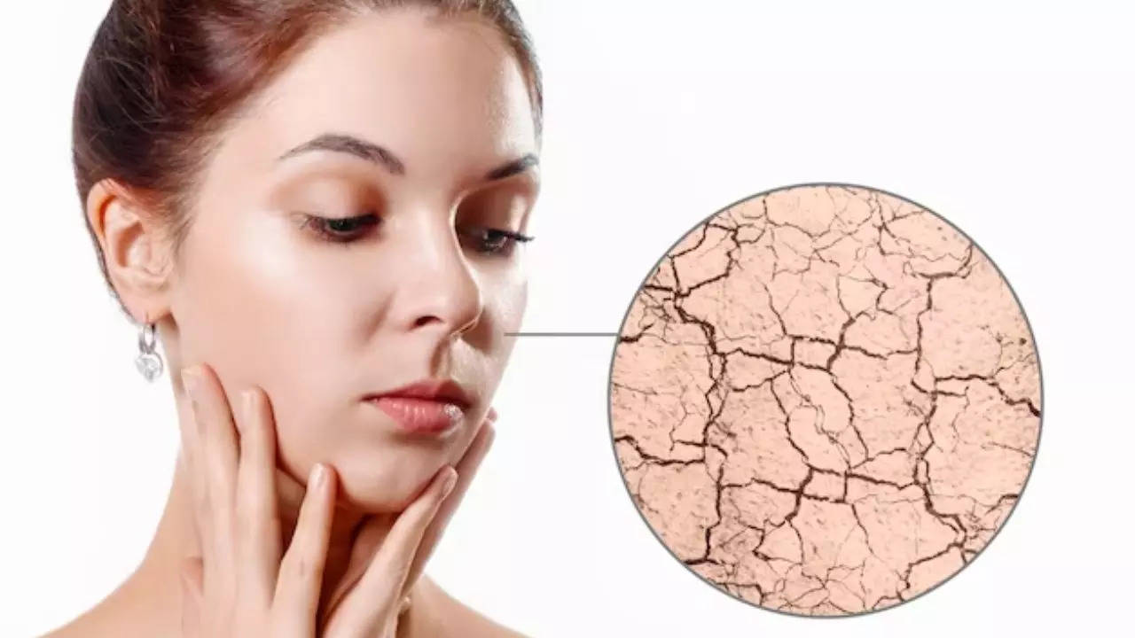 Ayurvedic Tips for Dry Skin