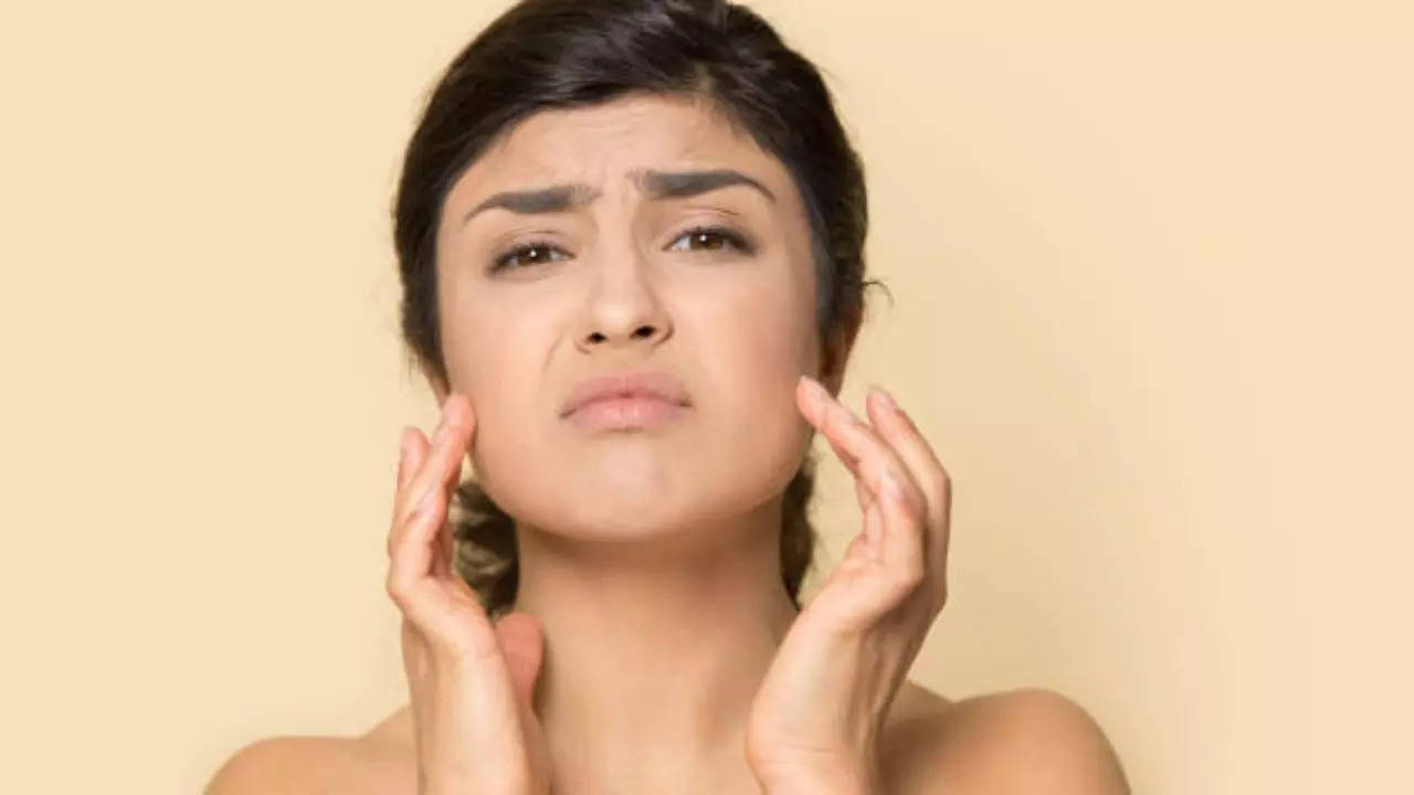 Home Remedies To Reduce Open Pores