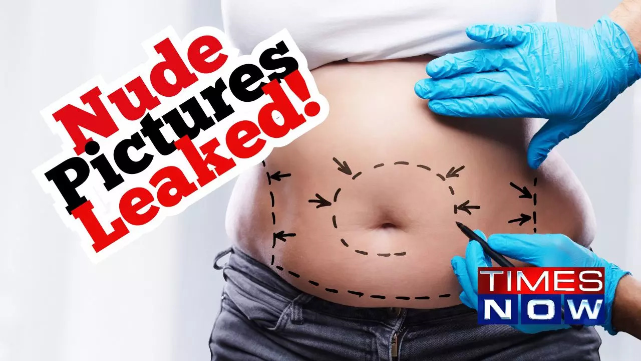 Plastic Surgeons Hit by Hackers: Patients Nude Photos and Private Data  Leaked | Technology & Science News, Times Now