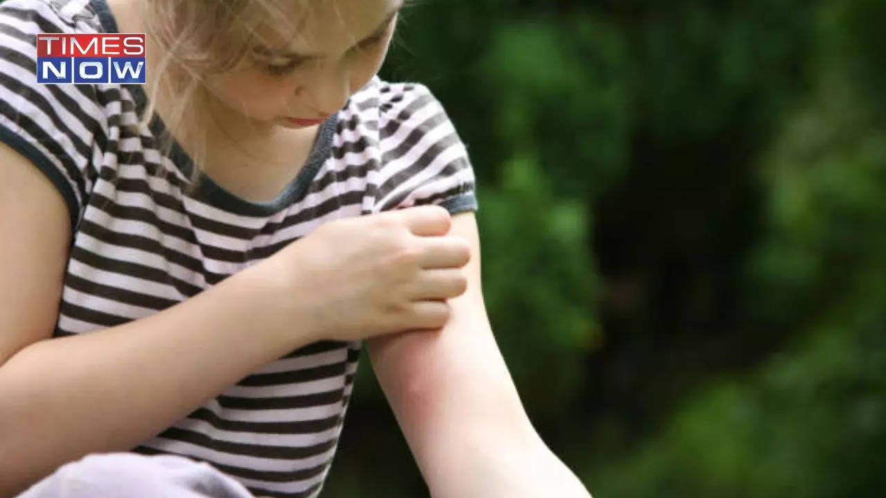 Chikungunya Vaccine