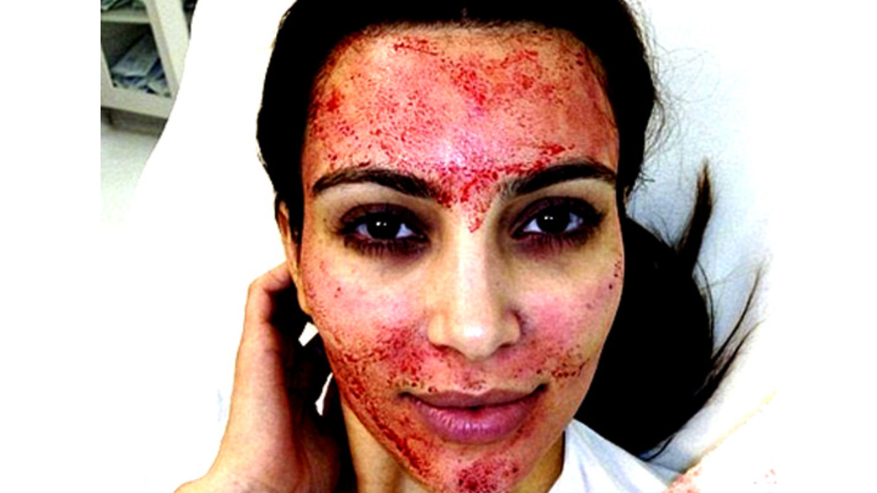 Crazy facials loved by celebs