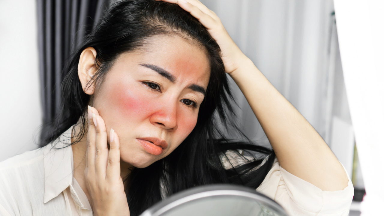 How to get rid of skin redness