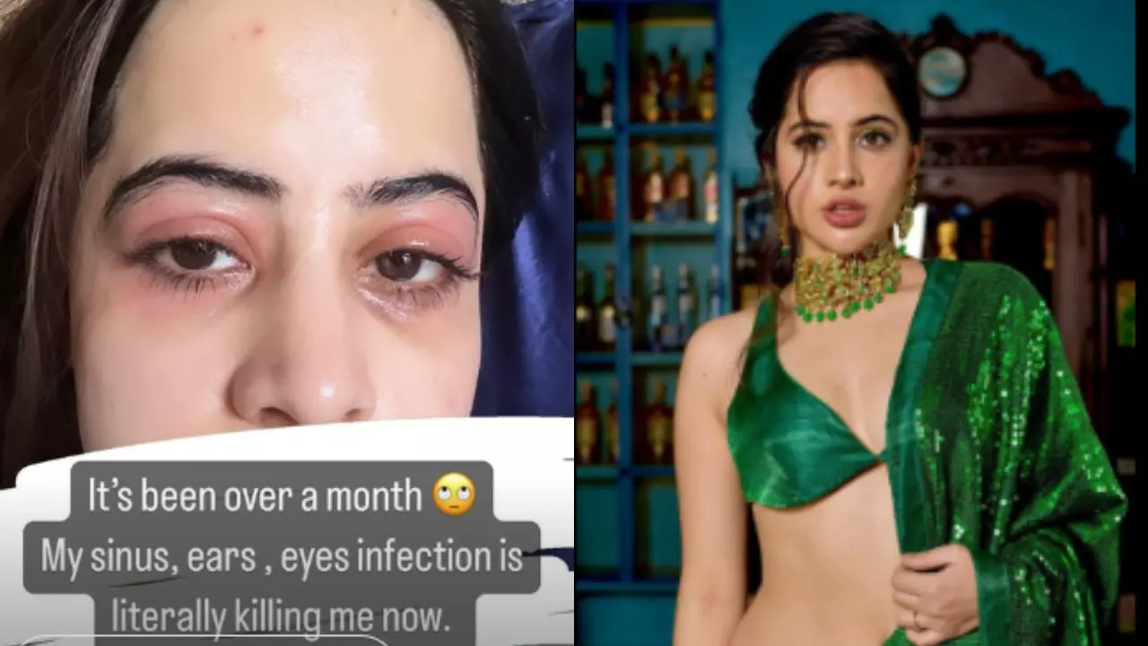 Urfi Javed Shares Pic Of Her Sinus, Eyes Infection: 'It's Killing Me'