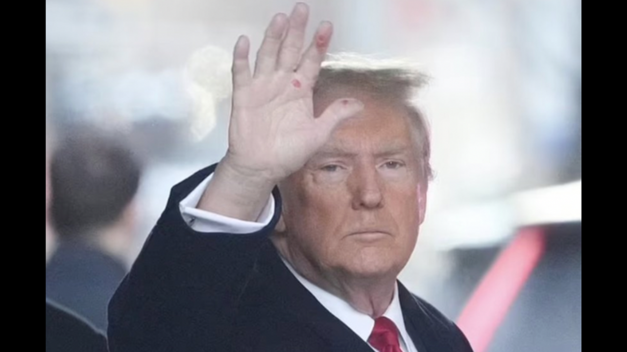 Syphilis Red Hands: Trump Believes 'Syphilis Red Hands' Was An AI Image ...