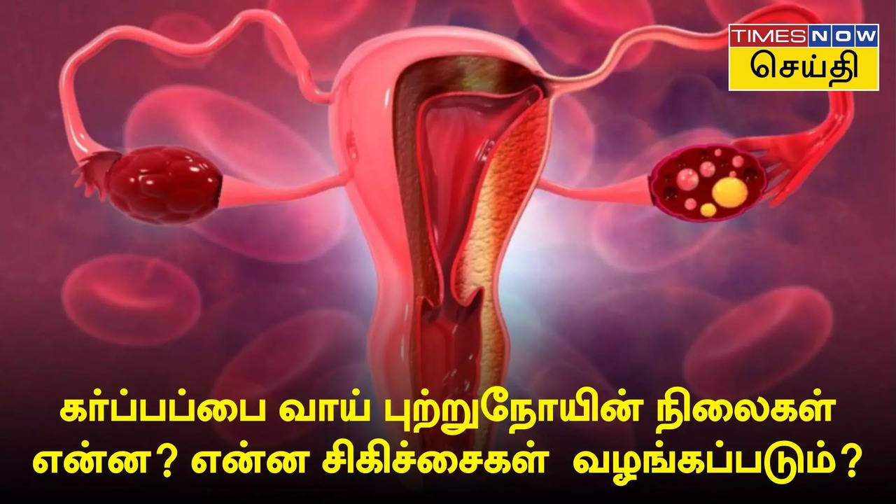 கர்ப்பப்பை வாய் புற்றுநோய் 