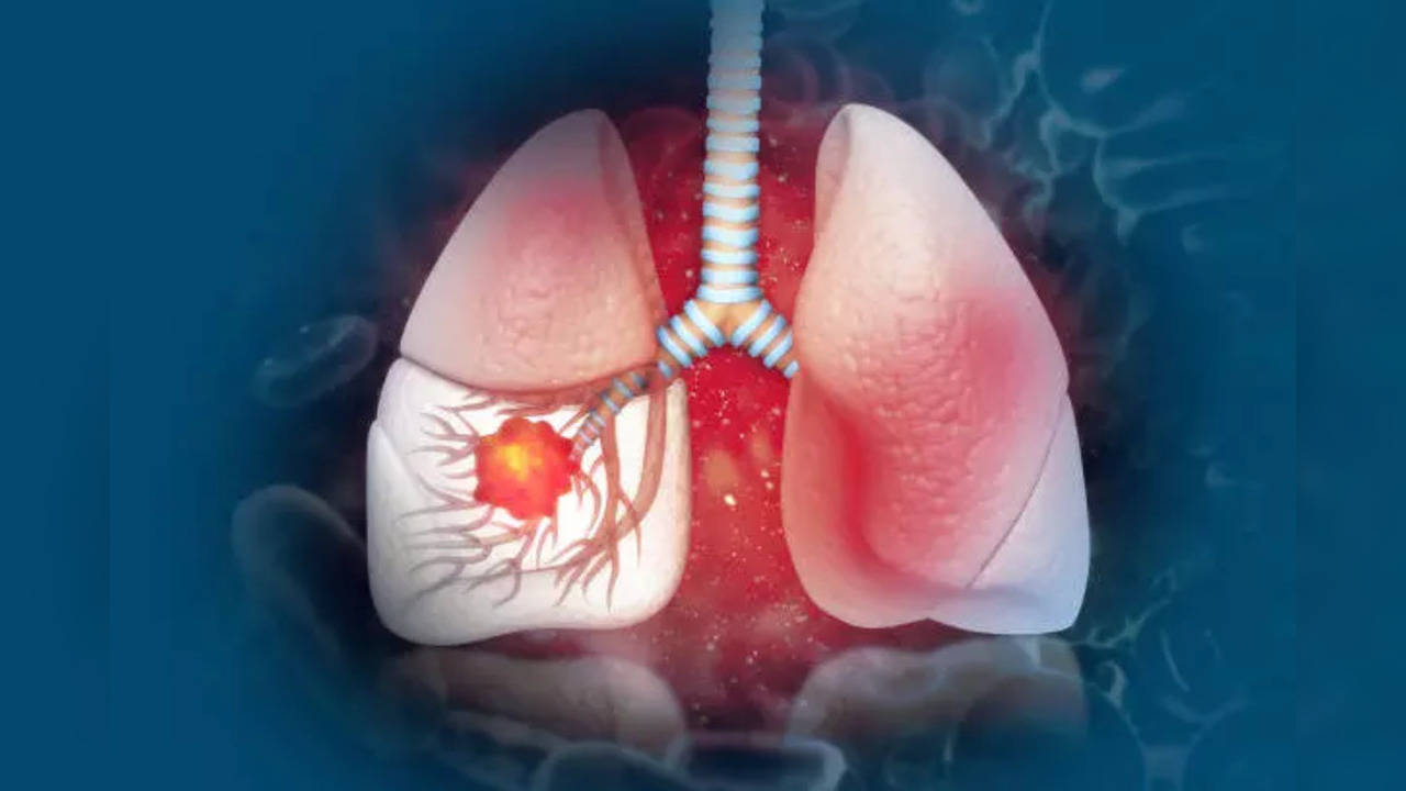 Popcorn can cause lung damage know the symptoms of Popcorn Lungs