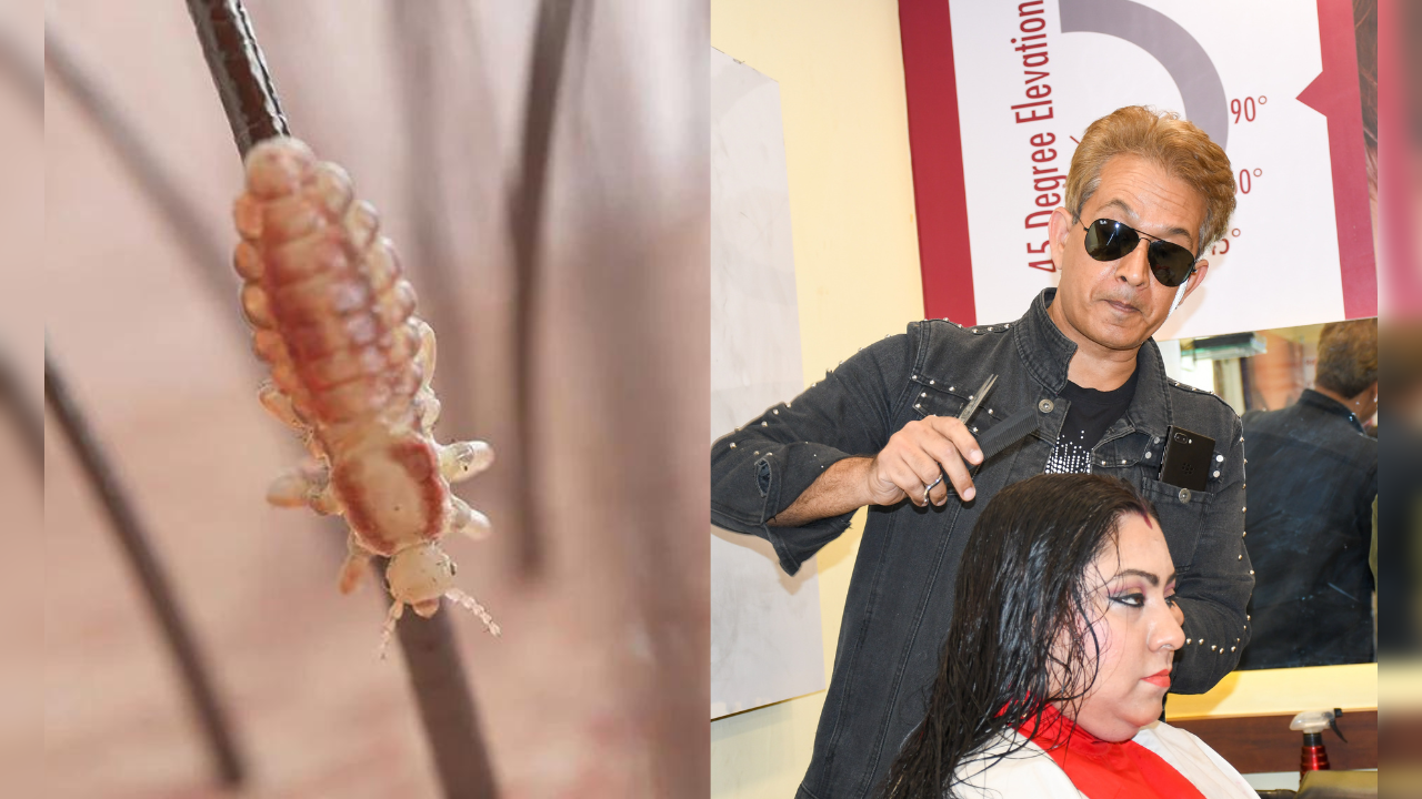 follow hair expert jawed habib's tips and get 100 relief from hair  lice