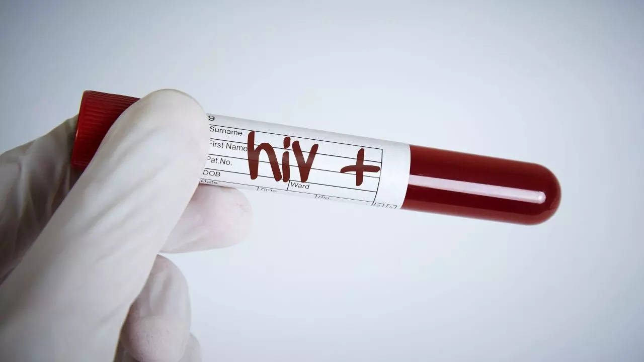 HIV Signs and Symptoms: Causes, Risk Factors and Preventive Measures you  Should Know About HIV | Health News, Times Now