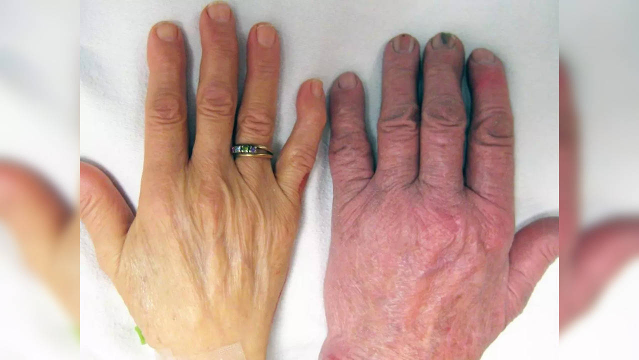 these 4 serious diseases change the color of hands and feet.