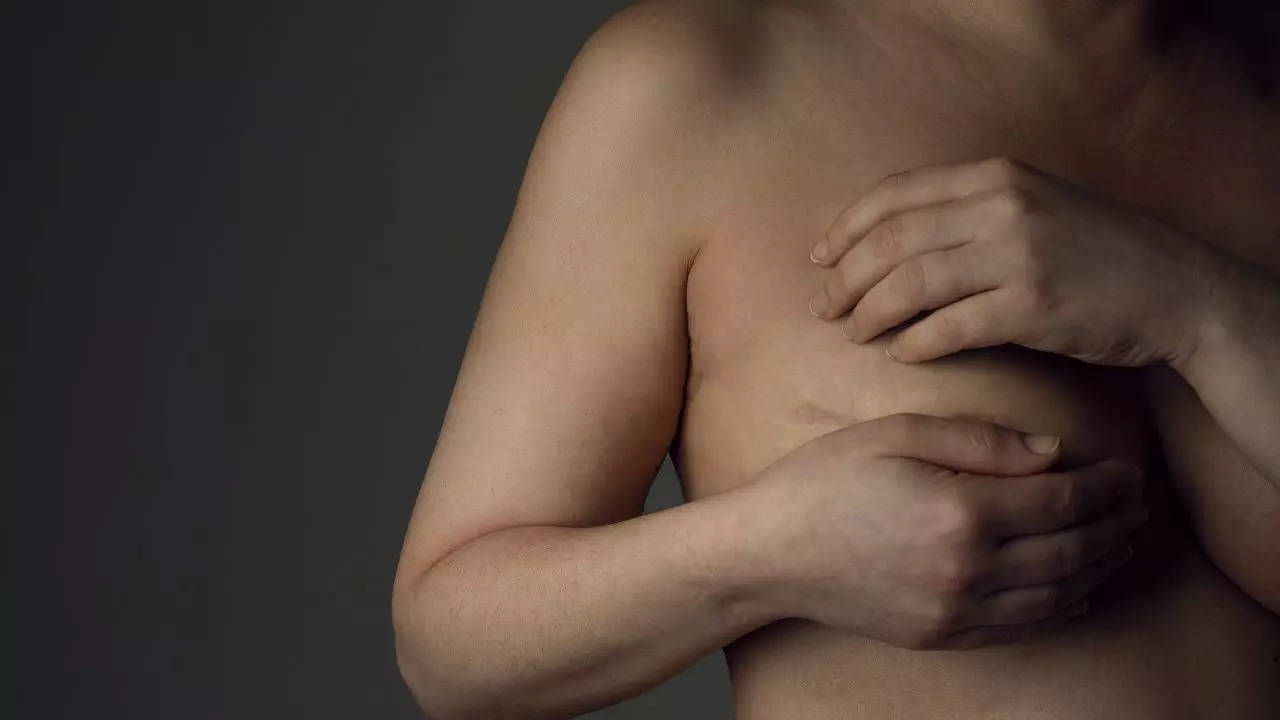 Risk-Reducing Mastectomy