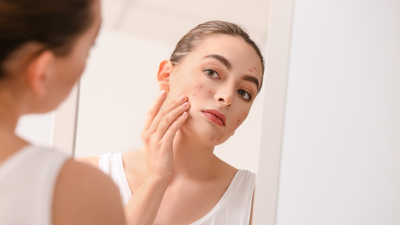 An expert shares 8 worst skincare advice that has been believed to be true. Pic Credit: Canva​