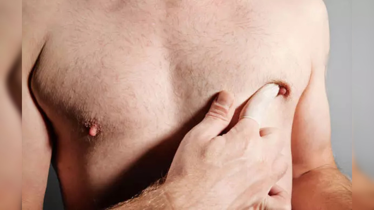 Male Breast Cancer: Signs and Symptoms of Breast Cancer in Men, Types and  Risk Factors | Health News, Times Now