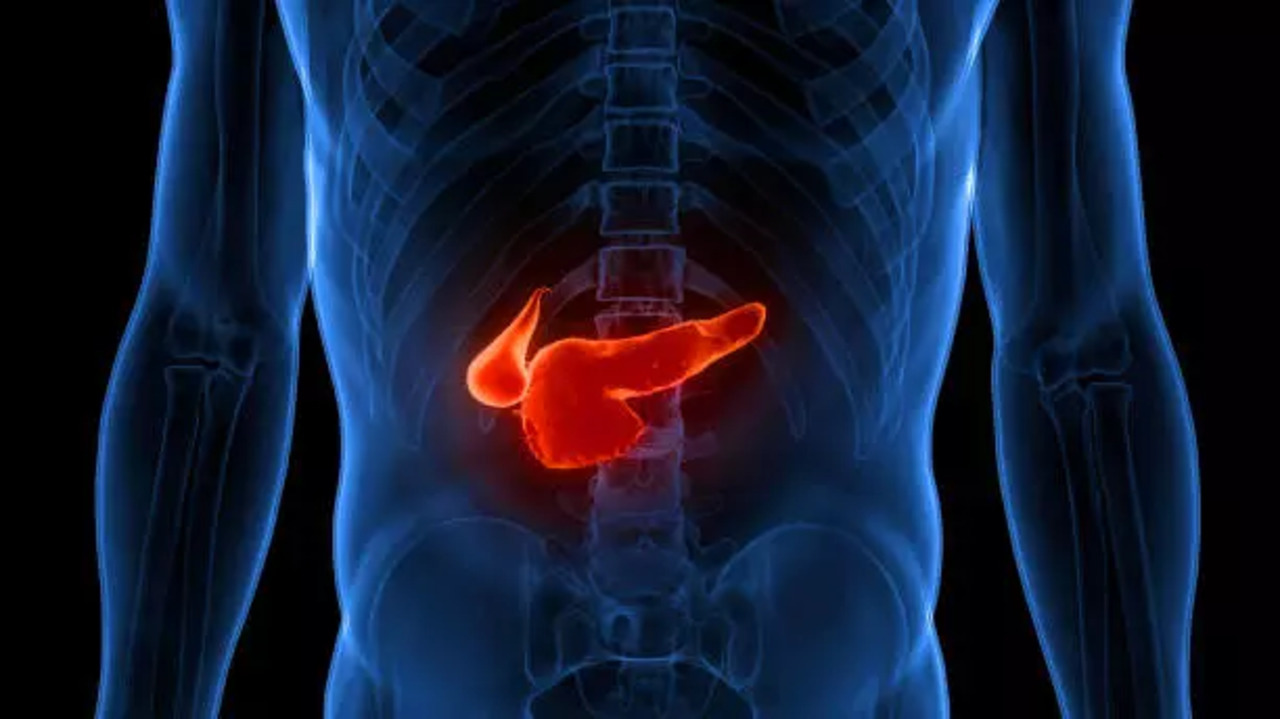 pancreatic cancer