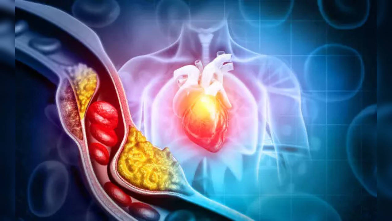 peripartum cardiomyopathy