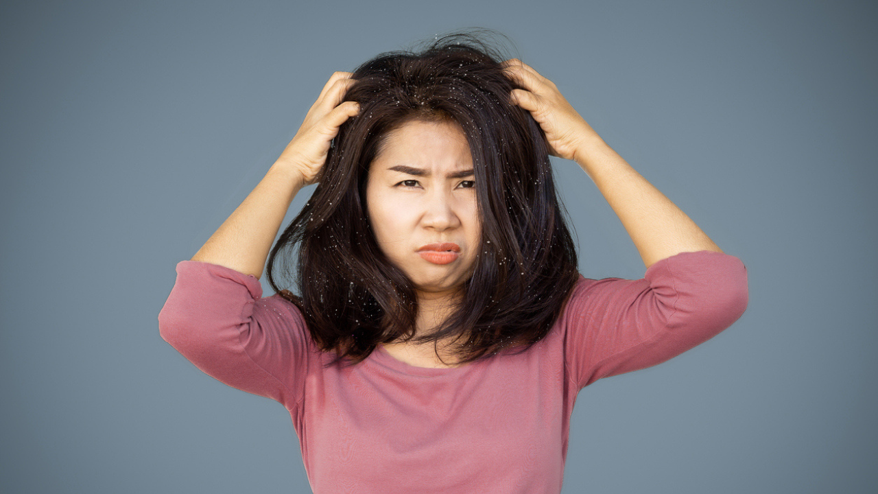 Hair Care Tips Suffering From Flaky Scalp? Expert Jots Down Ways You